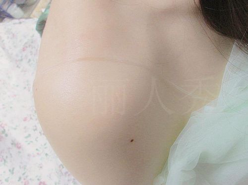 Bretelles pour lingerie - Ref 806070