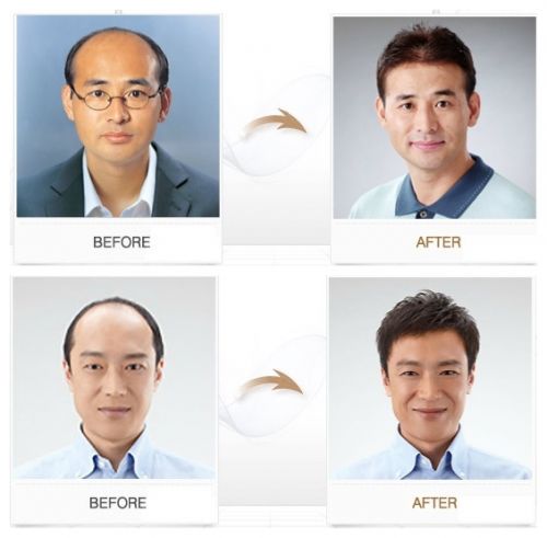 Extension cheveux - Ref 216851