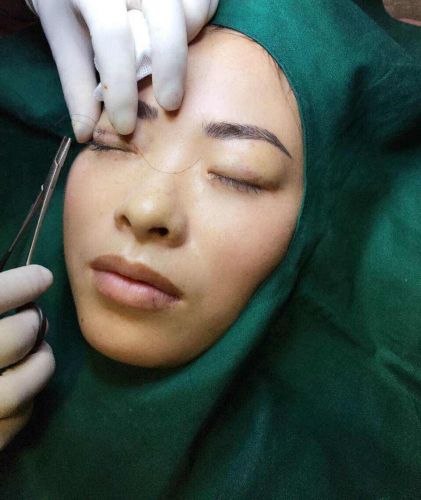 Tenue infirmière - Ref 1862099